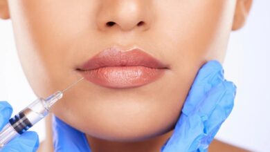 lip line fillers