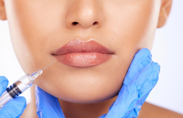 lip line fillers